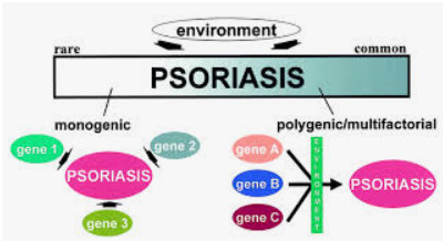 psoriasis genetics
